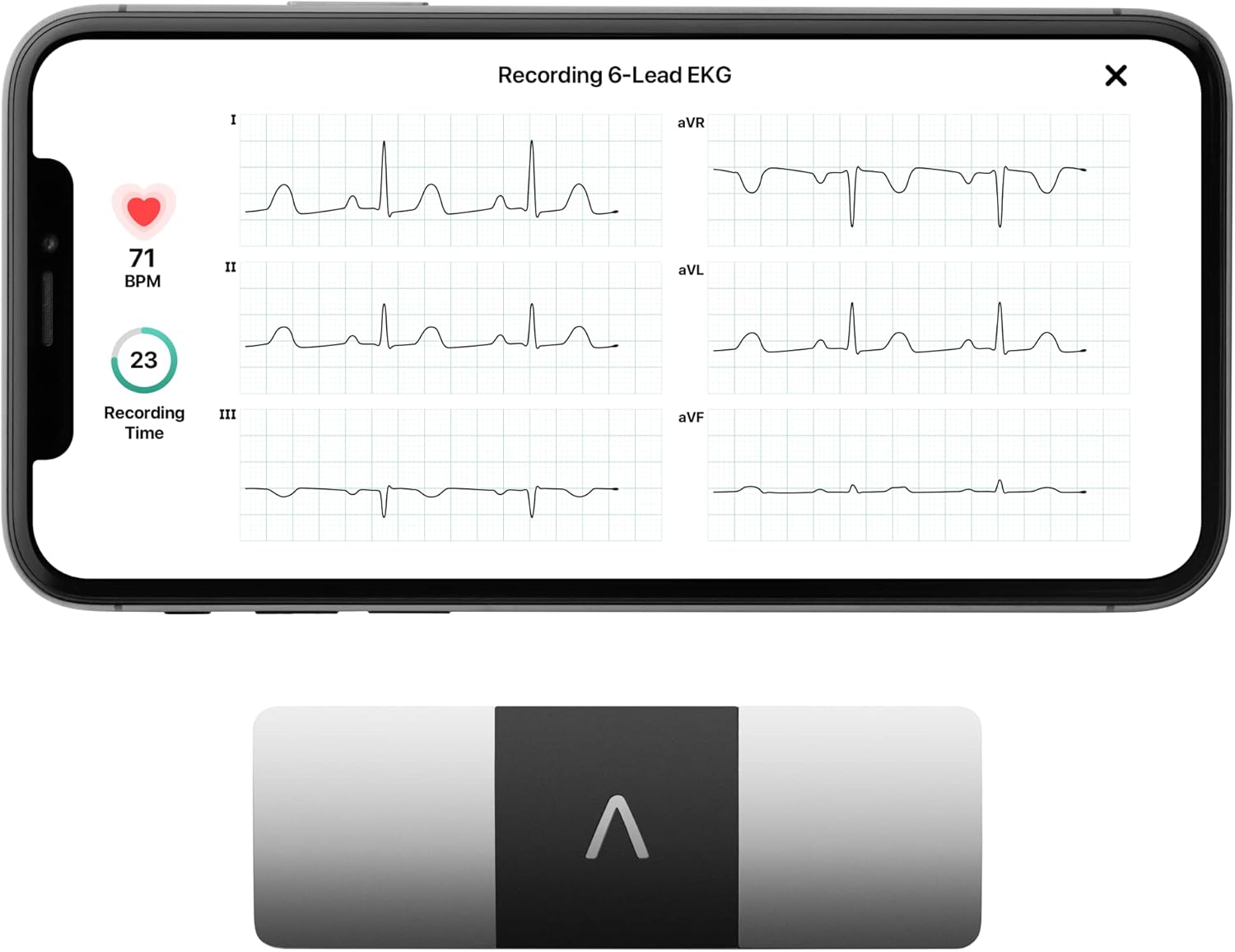 Stay in Tune with Your Heart: A Guide for Seniors to the KardiaMobile 6-Lead Personal EKG Monitor